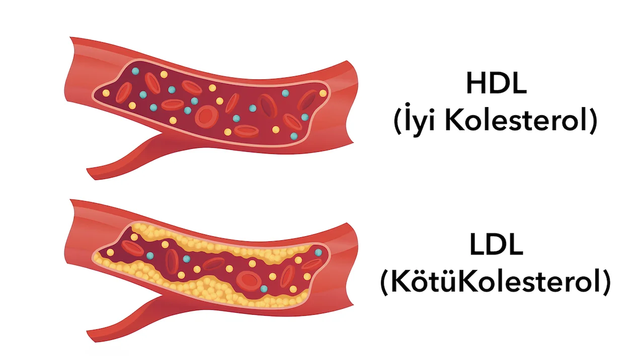 HDL Kolesterol ve LDL Kolesterol