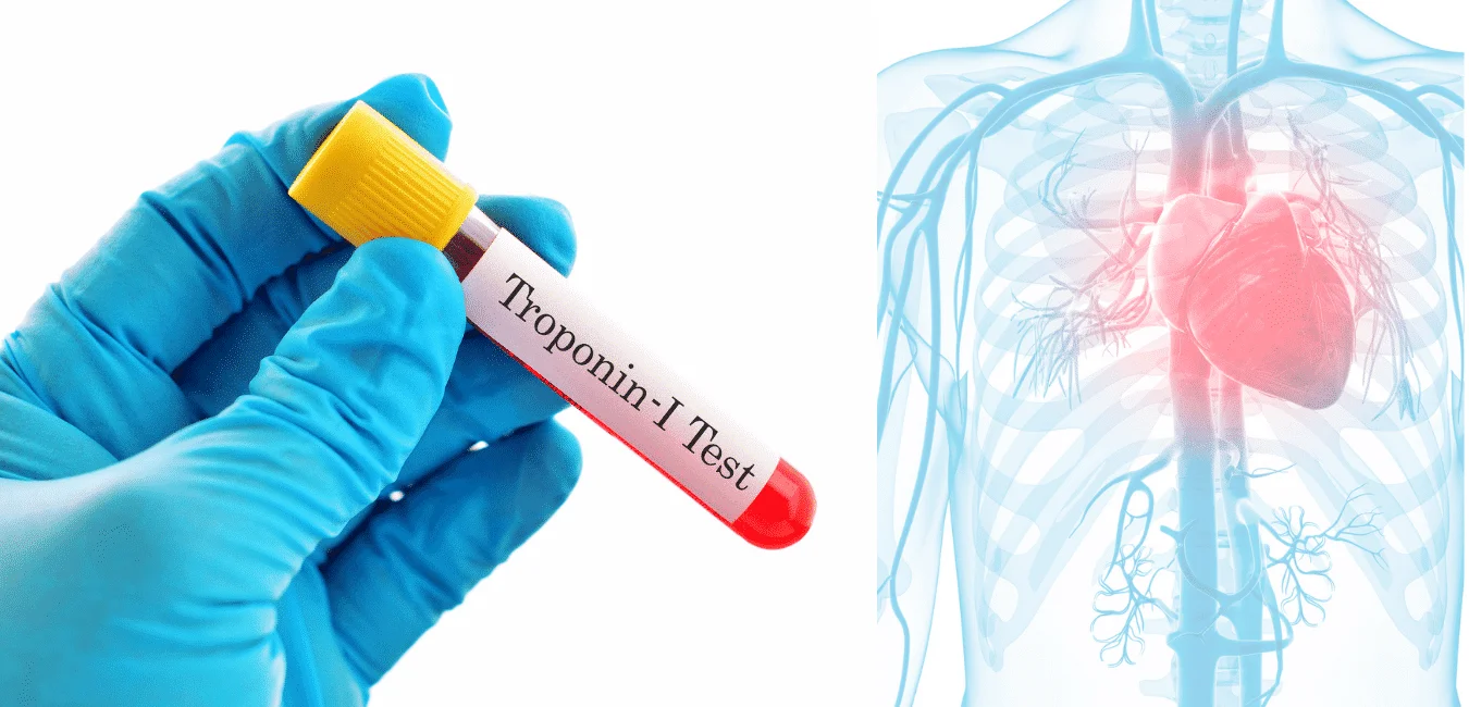 Troponin testi